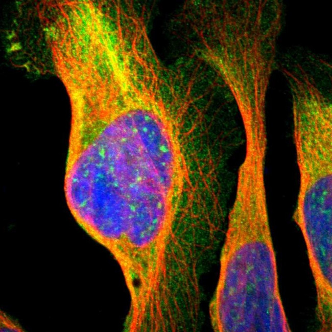 NMT2 Antibody in Immunocytochemistry (ICC/IF)