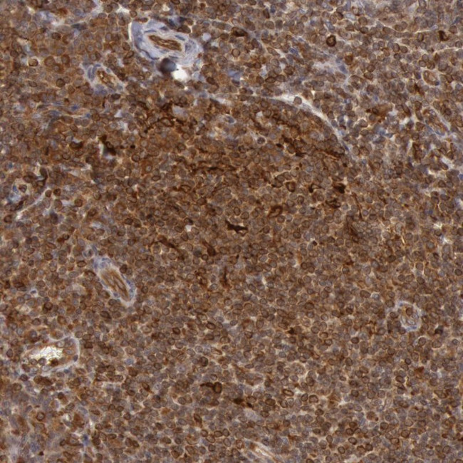 TAP2 Antibody in Immunohistochemistry (Paraffin) (IHC (P))