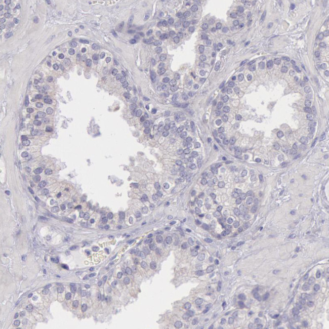 MYH6 Antibody in Immunohistochemistry (Paraffin) (IHC (P))