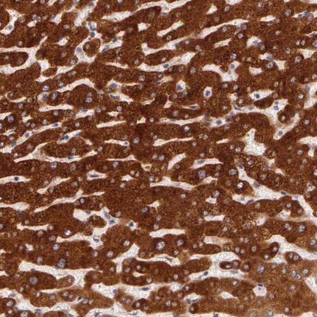 PACS2 Antibody in Immunohistochemistry (Paraffin) (IHC (P))