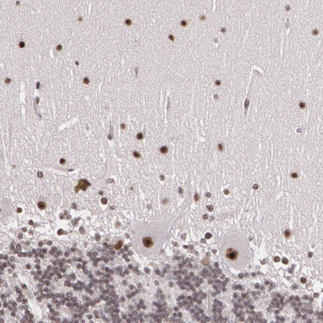 C6orf15 Antibody in Immunohistochemistry (Paraffin) (IHC (P))