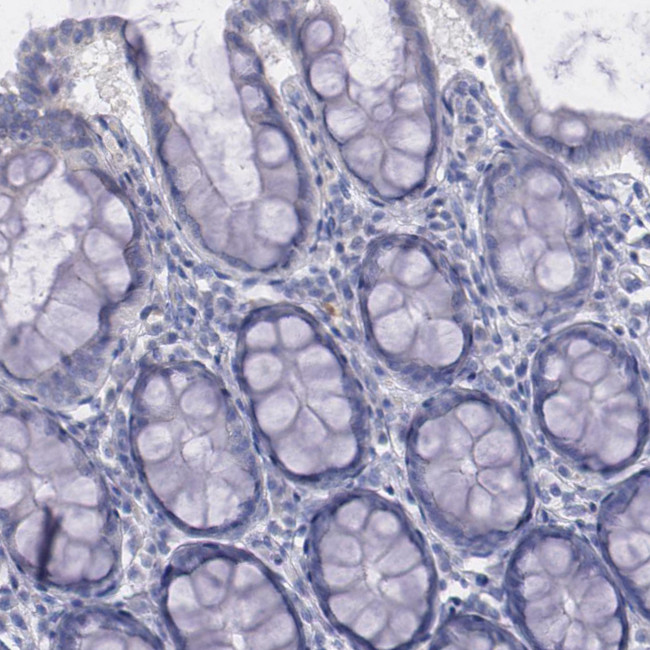 alpha-1 Microglobulin Antibody in Immunohistochemistry (Paraffin) (IHC (P))