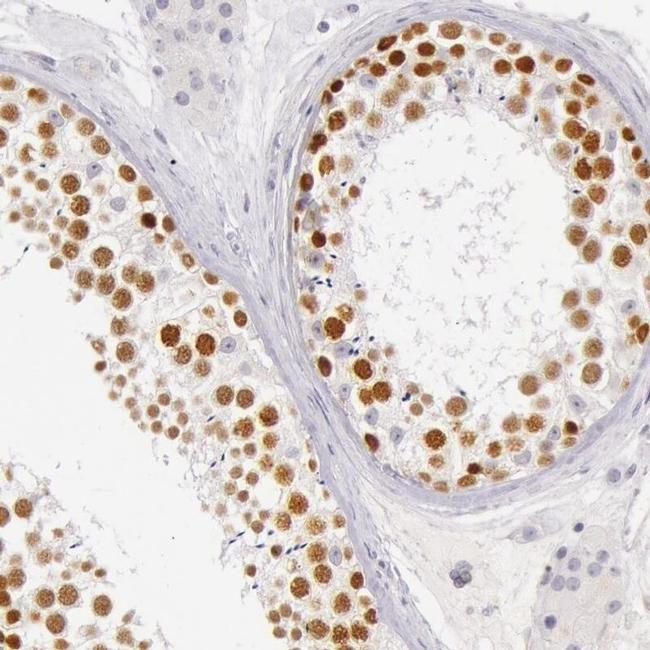 RBMY1A1 Antibody in Immunohistochemistry (IHC)