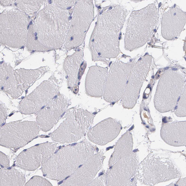 Fibulin 1 Antibody in Immunohistochemistry (Paraffin) (IHC (P))