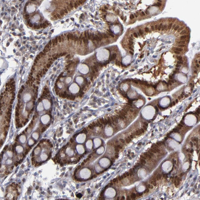 RREB1 Antibody in Immunohistochemistry (Paraffin) (IHC (P))