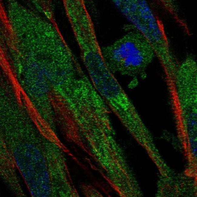 Complement Factor B Antibody in Immunocytochemistry (ICC/IF)