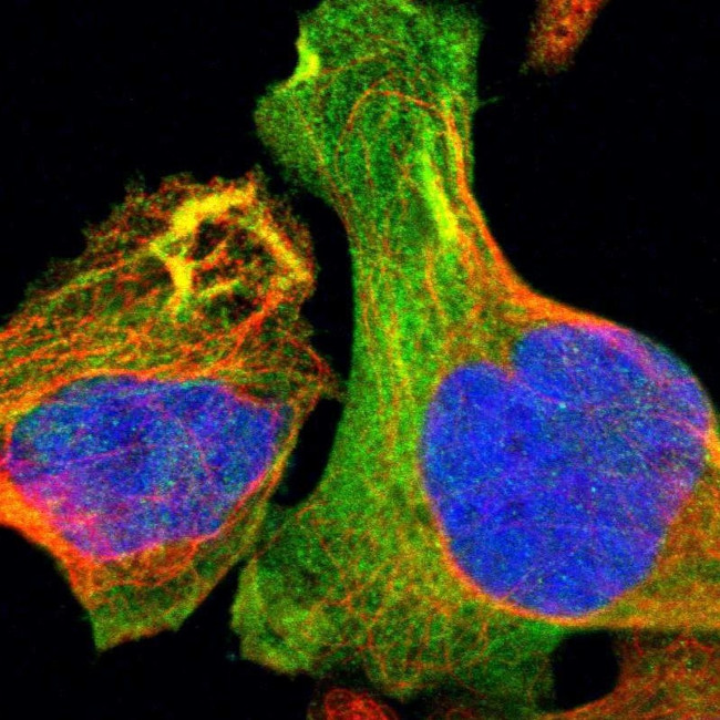 TMOD3 Antibody in Immunocytochemistry (ICC/IF)