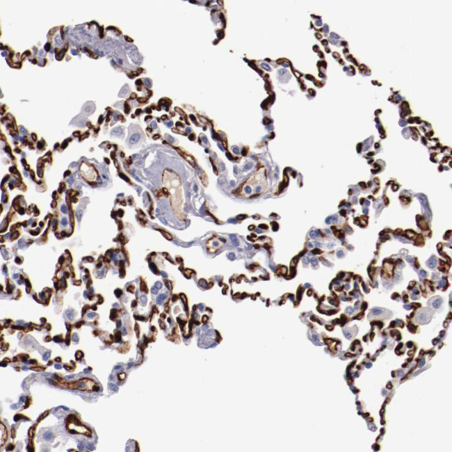 PRX Antibody in Immunohistochemistry (Paraffin) (IHC (P))