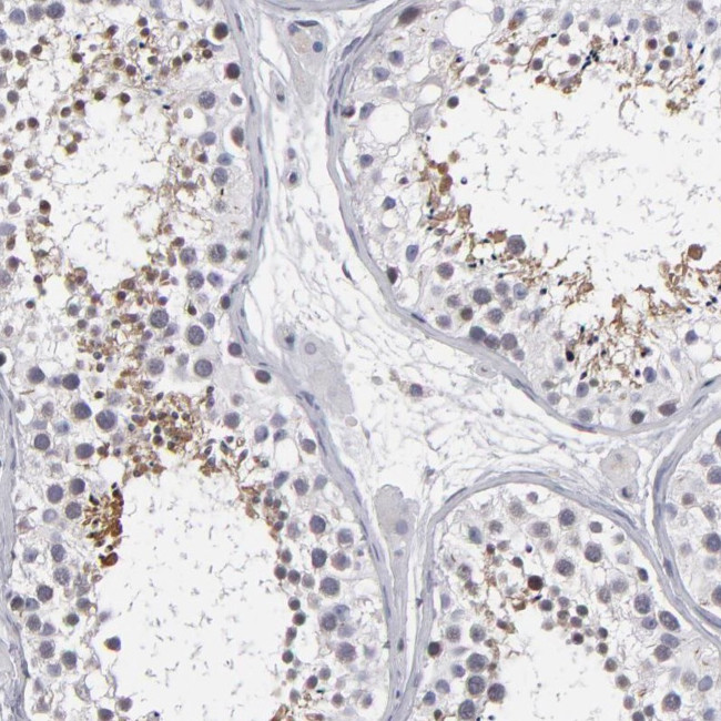 ODF2 Antibody in Immunohistochemistry (Paraffin) (IHC (P))