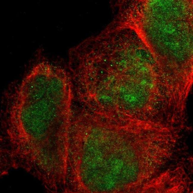 SIX1 Antibody in Immunocytochemistry (ICC/IF)