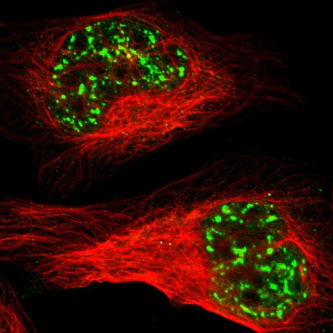 MBD4 Antibody in Immunocytochemistry (ICC/IF)