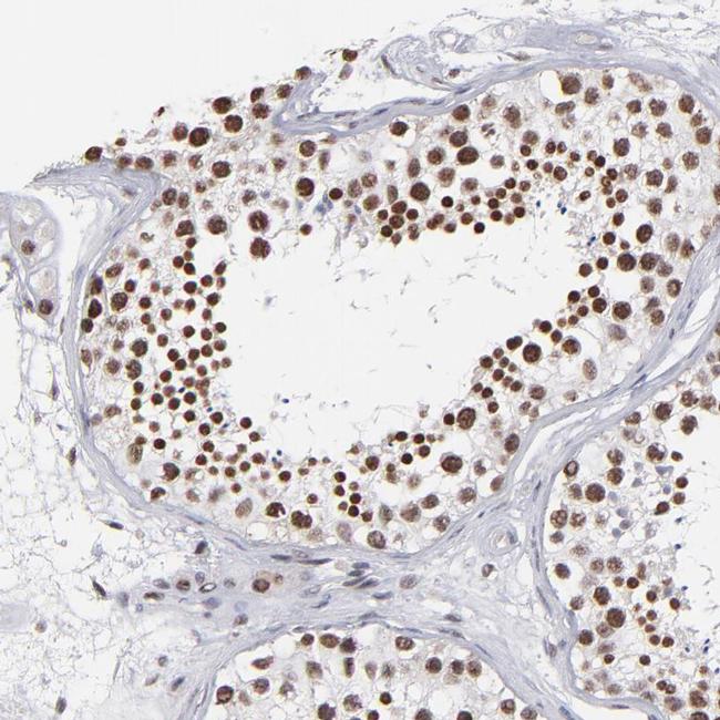 IGF2BP3 Antibody in Immunohistochemistry (IHC)