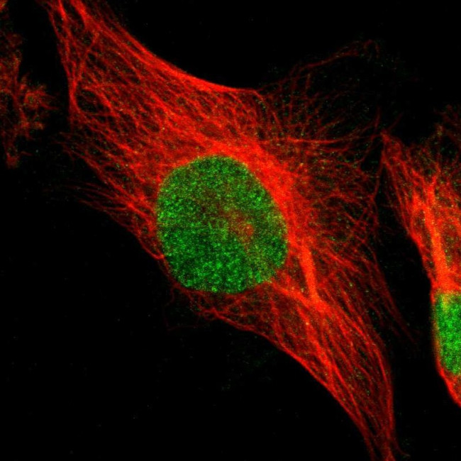 PSMC4 Antibody in Immunocytochemistry (ICC/IF)