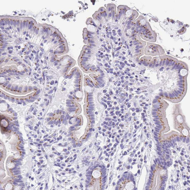 SULT1B1 Antibody in Immunohistochemistry (Paraffin) (IHC (P))