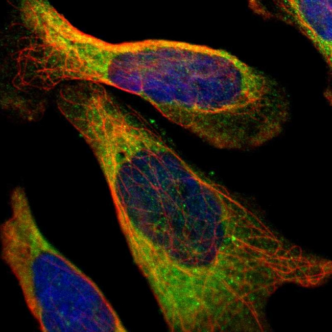 PFKM Antibody in Immunocytochemistry (ICC/IF)