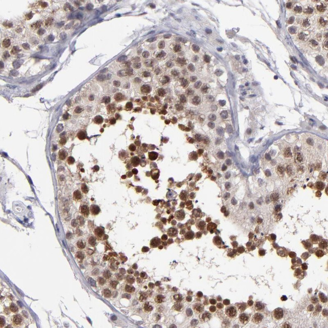 OTUB2 Antibody in Immunohistochemistry (Paraffin) (IHC (P))