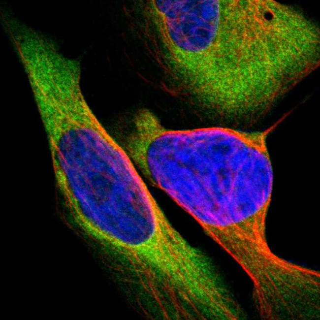 CARS Antibody in Immunocytochemistry (ICC/IF)