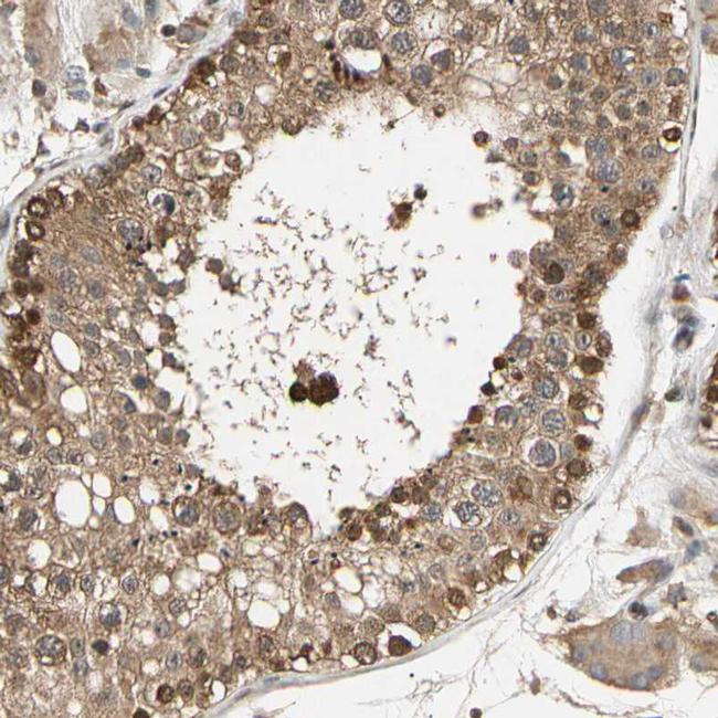 eIF1AX Antibody in Immunohistochemistry (IHC)