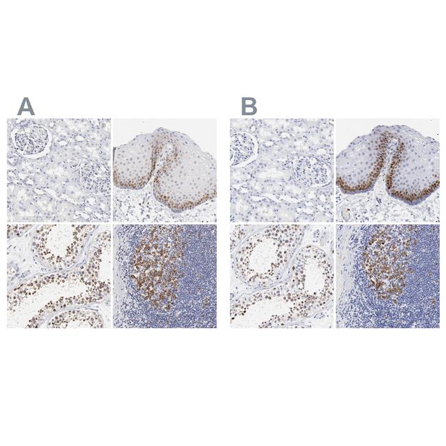 NCAPH Antibody in Immunohistochemistry (IHC)