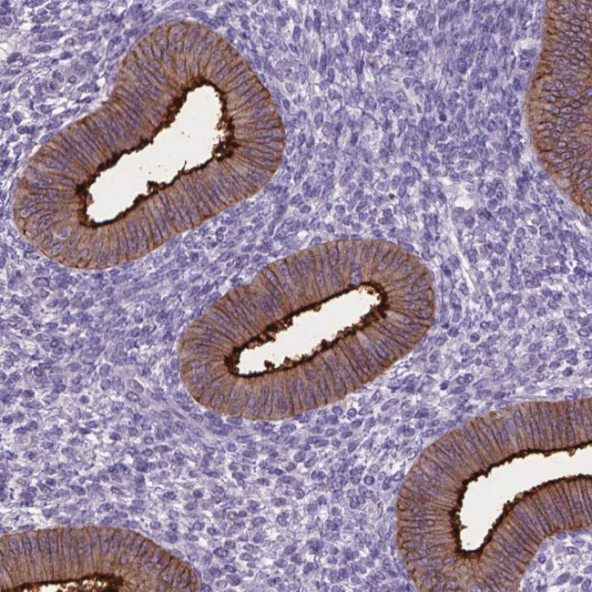 Carboxypeptidase M Antibody in Immunohistochemistry (Paraffin) (IHC (P))