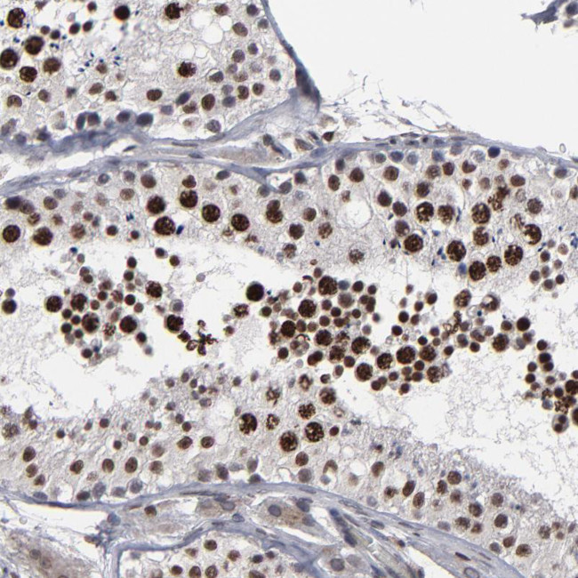 BAZ1A Antibody in Immunohistochemistry (Paraffin) (IHC (P))