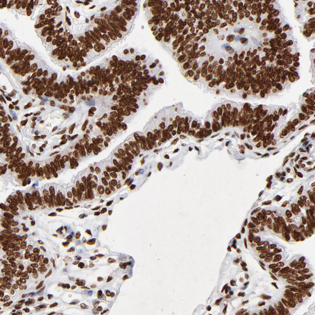 FBXO18 Antibody in Immunohistochemistry (Paraffin) (IHC (P))