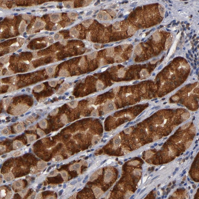 ALG13 Antibody in Immunohistochemistry (Paraffin) (IHC (P))