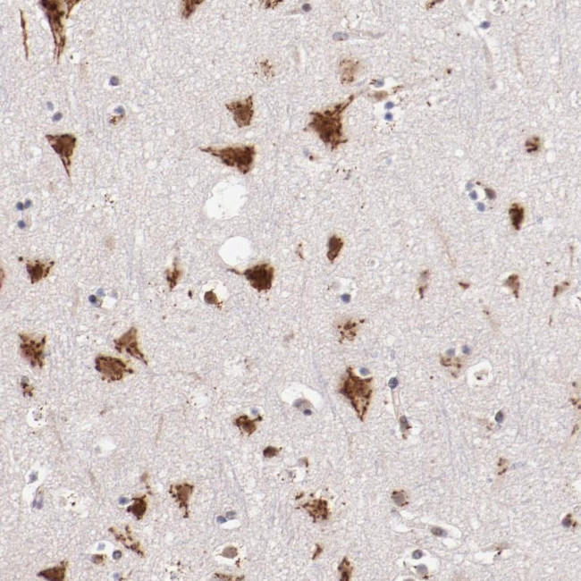 BEGAIN Antibody in Immunohistochemistry (Paraffin) (IHC (P))