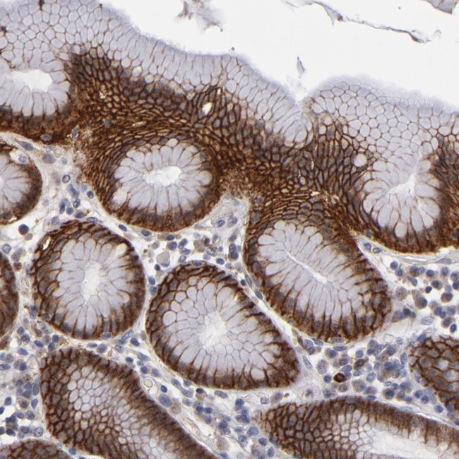 EXD2 Antibody in Immunohistochemistry (Paraffin) (IHC (P))