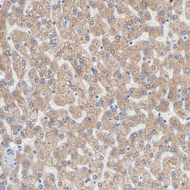 AADAC Antibody in Immunohistochemistry (Paraffin) (IHC (P))