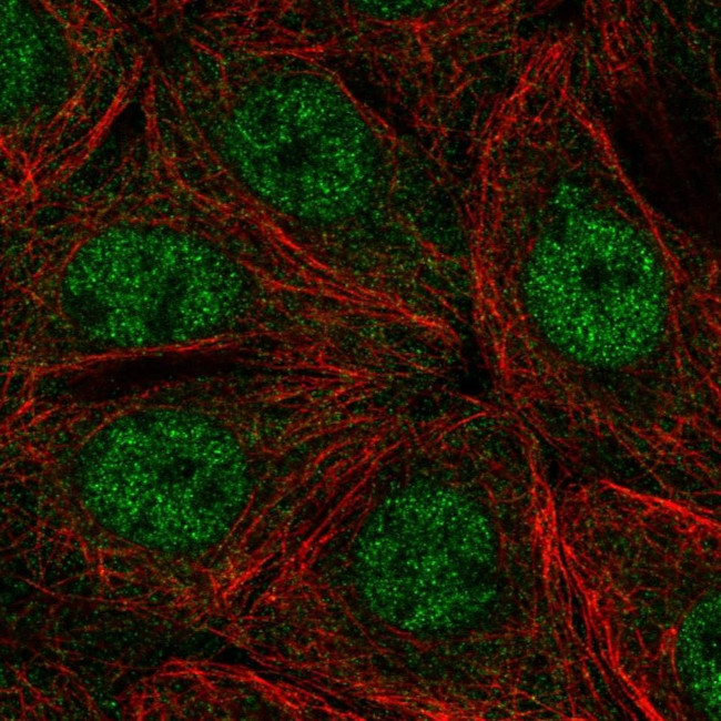 PHKA2 Antibody in Immunocytochemistry (ICC/IF)