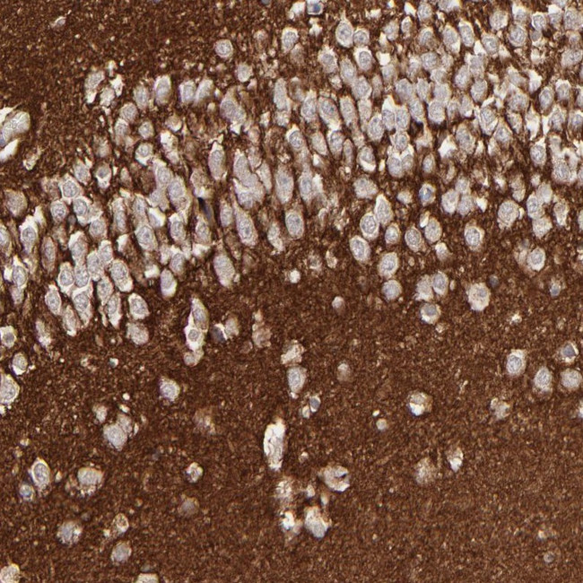 GPM6B Antibody in Immunohistochemistry (Paraffin) (IHC (P))