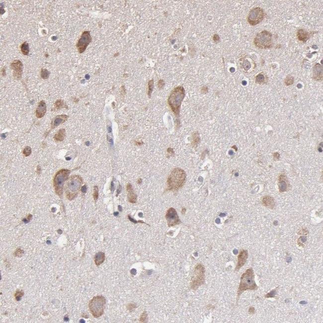 OPHN1 Antibody in Immunohistochemistry (IHC)