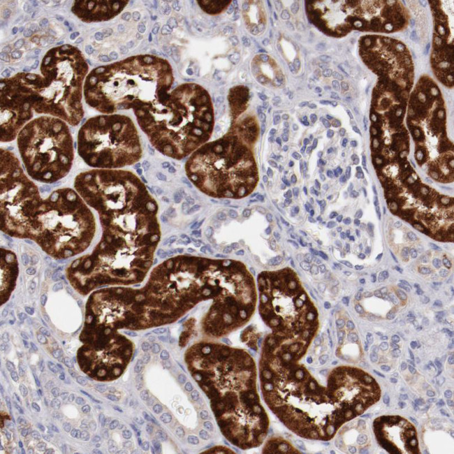 ENTPD5 Antibody in Immunohistochemistry (Paraffin) (IHC (P))