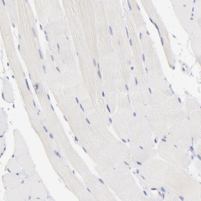 Lrmp Antibody in Immunohistochemistry (Paraffin) (IHC (P))