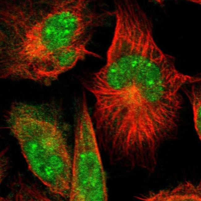 C6orf211 Antibody in Immunocytochemistry (ICC/IF)