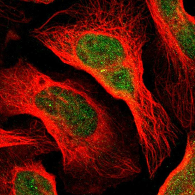 DACT1 Antibody in Immunocytochemistry (ICC/IF)