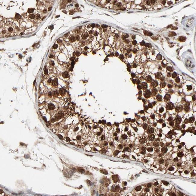 RhoJ Antibody in Immunohistochemistry (IHC)