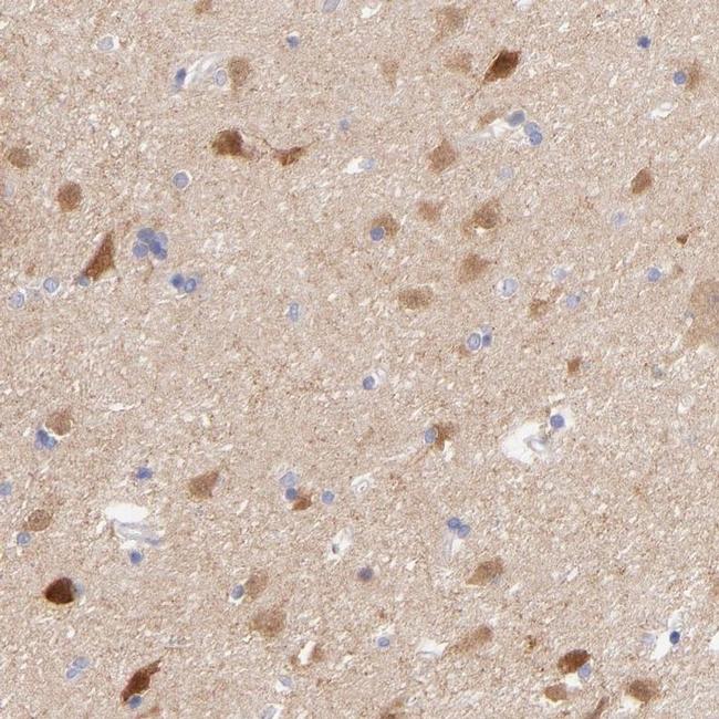 Gephyrin Antibody in Immunohistochemistry (IHC)