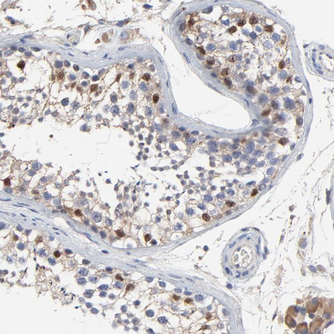 NXF3 Antibody in Immunohistochemistry (Paraffin) (IHC (P))