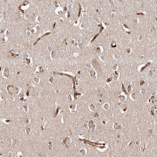 GTPBP1 Antibody in Immunohistochemistry (Paraffin) (IHC (P))