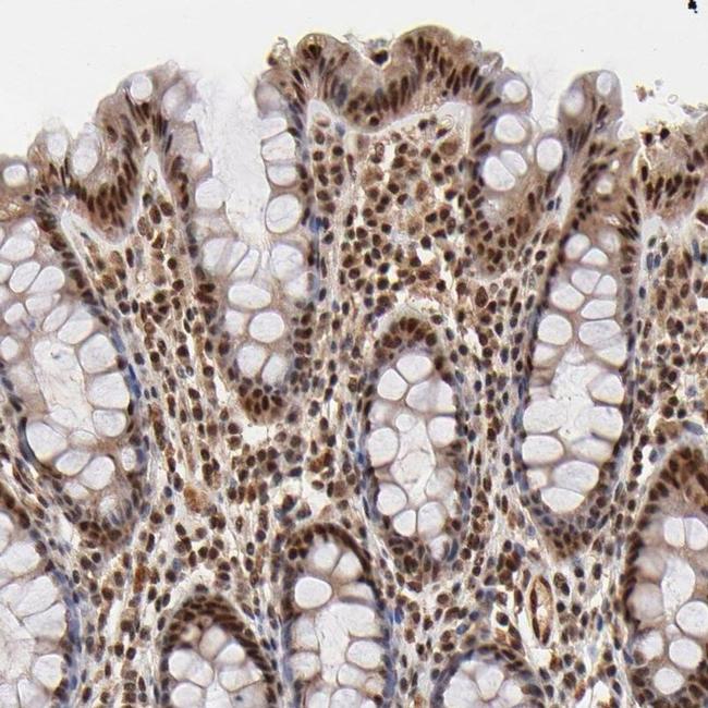 MED12 Antibody in Immunohistochemistry (IHC)