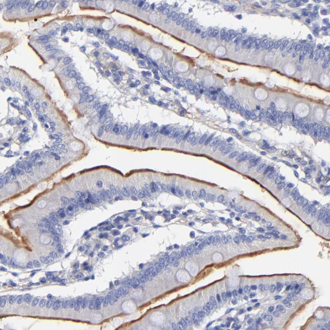 SLC44A2 Antibody in Immunohistochemistry (Paraffin) (IHC (P))