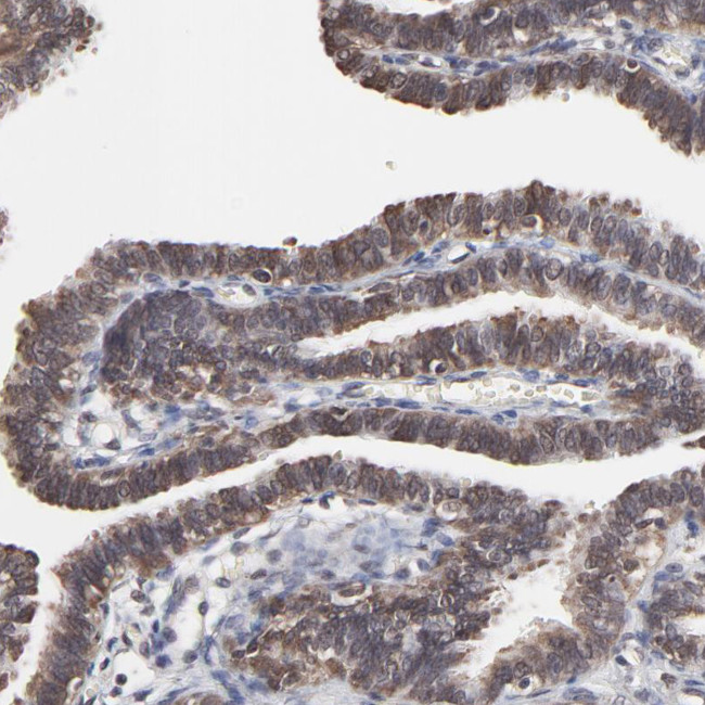 CHM Antibody in Immunohistochemistry (Paraffin) (IHC (P))