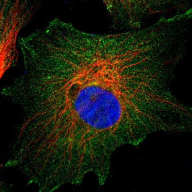 CD2AP Antibody in Immunocytochemistry (ICC/IF)