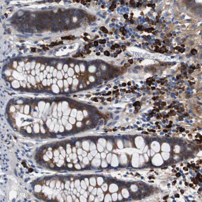 UBE2G2 Antibody in Immunohistochemistry (Paraffin) (IHC (P))