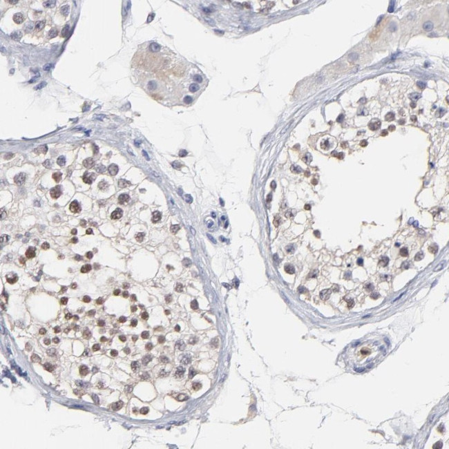 SMARCA1 Antibody in Immunohistochemistry (Paraffin) (IHC (P))