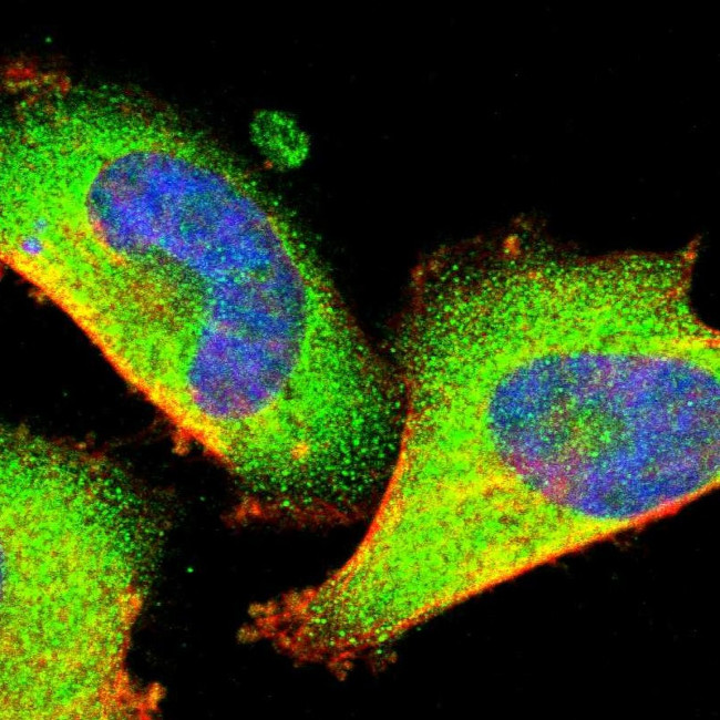 Optineurin Antibody in Immunocytochemistry (ICC/IF)