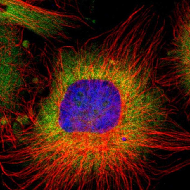 RPL9 Antibody in Immunocytochemistry (ICC/IF)