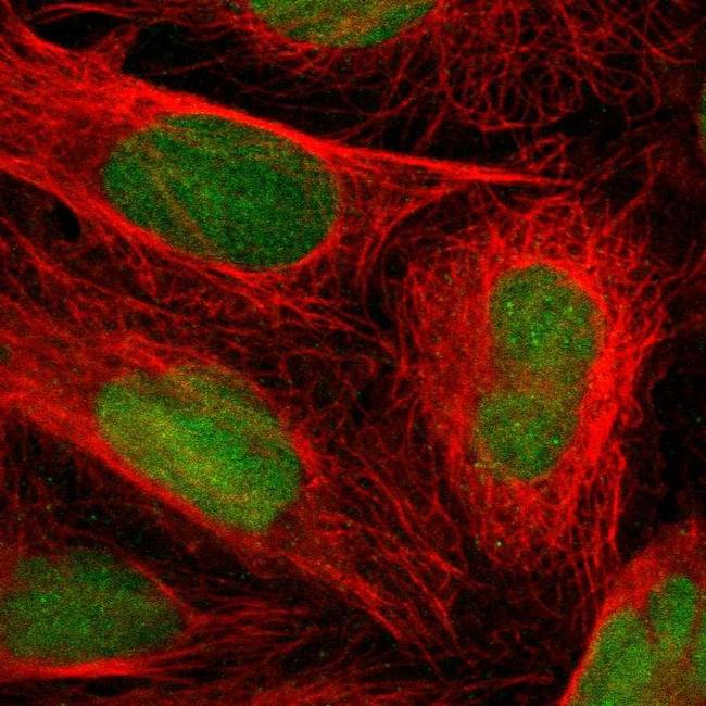 LTBP2 Antibody in Immunocytochemistry (ICC/IF)